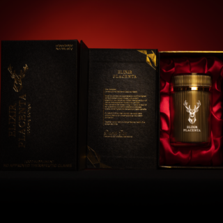 When Psoriatic Arthritis Crashes the Party: A Long-Term Guest